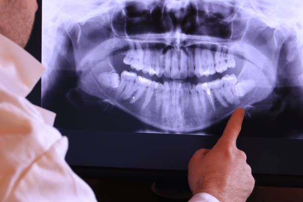 Best Emergency Dentist for Knocked-Out Tooth in Kathleen, FL