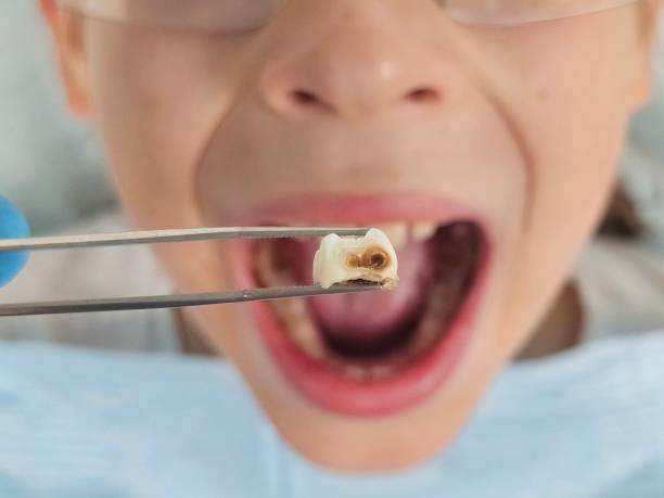 Best Emergency Dental Services for Seniors in Kathleen, FL